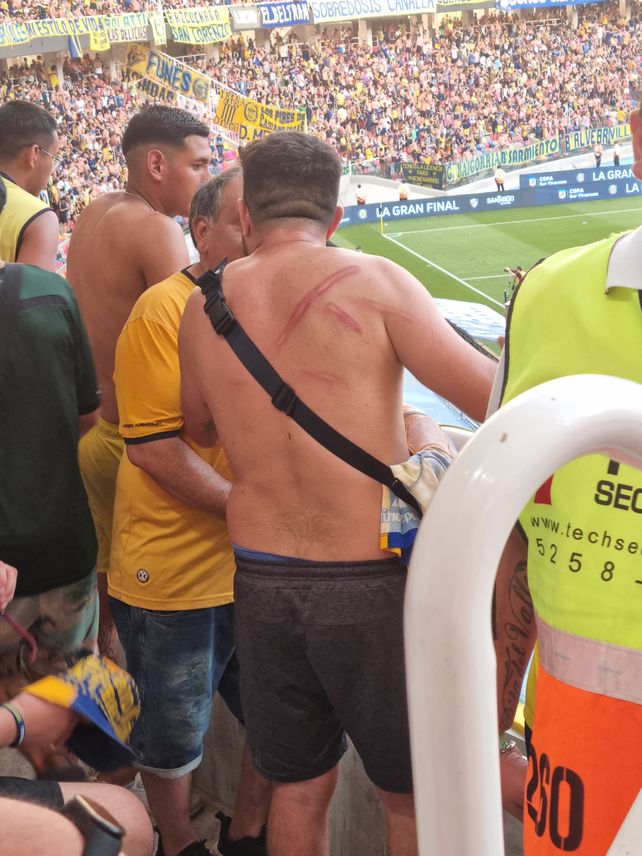 Las marcas de la represión que se desató en la espalda de un hincha de Central. Desorganización que llevó a desbordes
