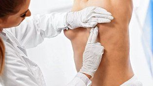 El diagnóstico. De cáncer de mama suele realizarse en estadios tempranos por hallazgos en los estudios de control (mamografía o ecografía), ya que los mismos detectan lesiones no palpables, indicó la mastóloga.