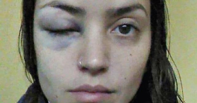 Así le quedó la cara tras el golpe que recibió. 