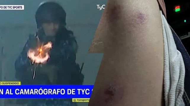 Camarógrafo sufrió tres balazos de goma durante los graves incidentes en el partido Gimnasia - Boca