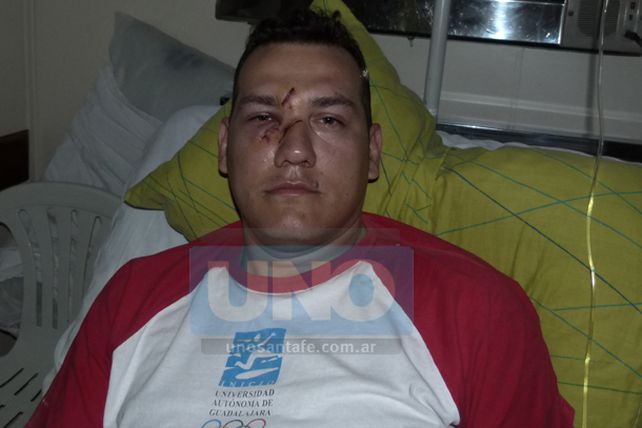 Hieren a un oficial de policía con un piedrazo