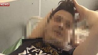 Una mujer sedujo y drogó a un joven actor ruso para amputarle sus genitales