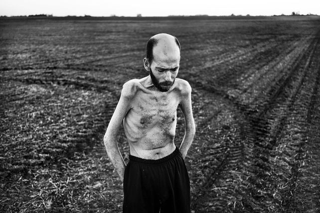 La muestra de fotografías El costo humano de los agrotóxicos se exhibirá en Cañada Rosquín