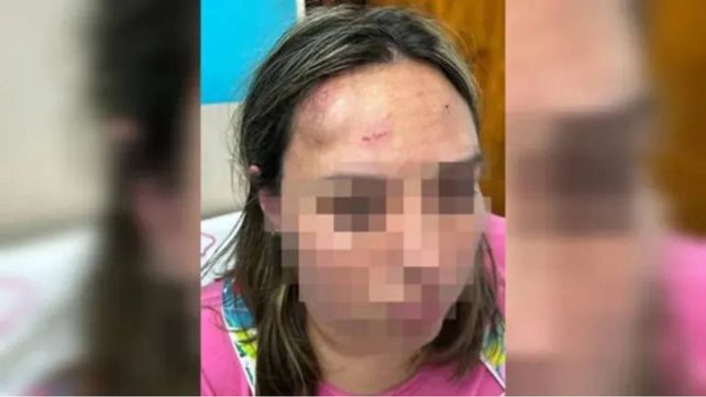 Madre e hija atacaron a golpes a una docente y le desfiguraron el rostro