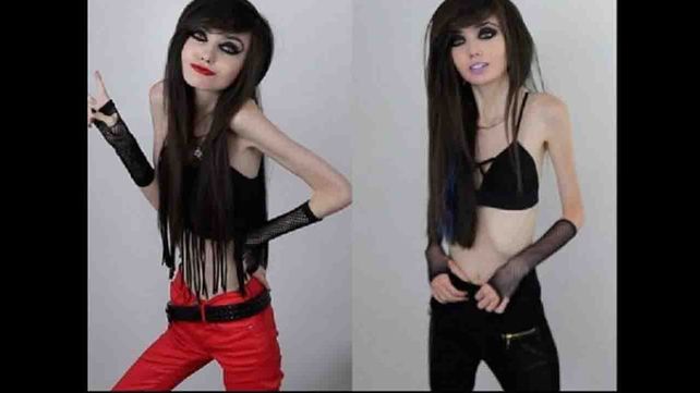 Polémica por una youtuber que promueve la anorexia