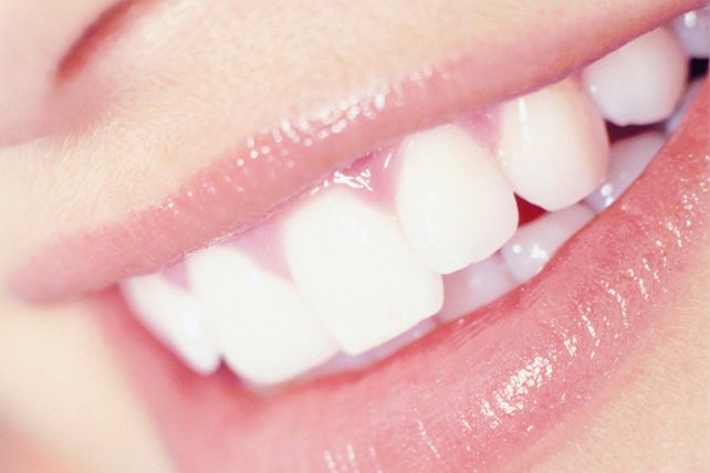 Alimentos que blanquean tus dientes sin esfuerzo