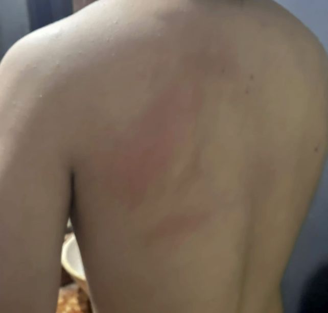 Brutal agresión en Santo Tomé: un hombre de 52 años golpeó con un palo a un adolescente tras una pelea entre perros