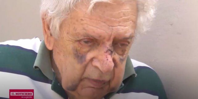 Golpearon Salvajemente A Un Abuelo De 82 Anos Para Robarle