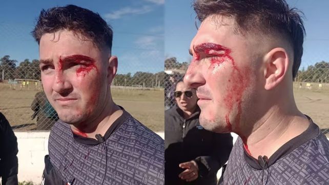 El árbitro fue golpeado en pleno campo de juego y debió ser derivado a un hospital.
