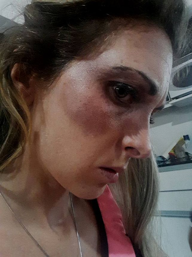 Rosario: le quisieron arrebatar a su hija a golpes y descargó toda su furia en Facebook