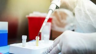 Coronavirus: la provincia registró un nuevo récord de contagios y la ciudad sumó 11 positivos