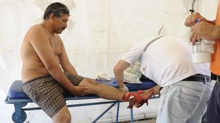 Rosario: más de 60 casos por ataque de palometas