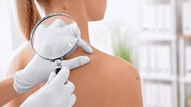 Villa Elisa: campaña de prevención del cáncer de piel