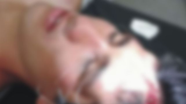 Policías molieron a golpes a un joven en un boliche de Las Toscas