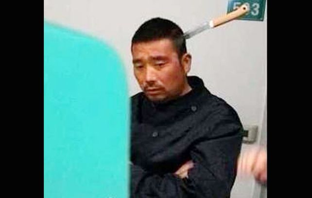 Chino con un cuchillo clavado en la cabeza es fenómeno en Internet
