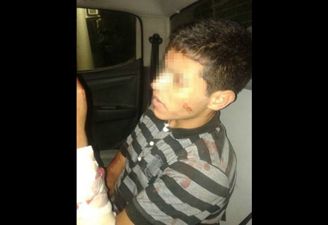 Así quedaron los delincuentes atacados por el samurai cordobés