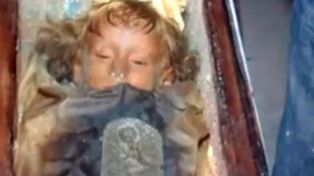 Misterio por el extraño caso de la nena momia que abre y cierra los ojos todos los días
