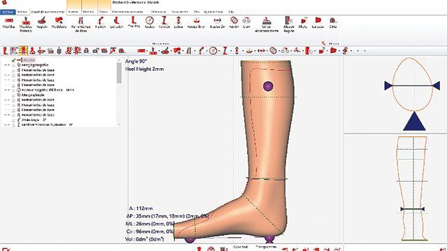Diseño y fabricación de productos ortoprotésicos