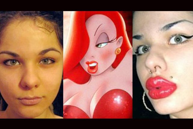 Fanatismo extremo: se inyecta 100 veces los labios para parecerse a Jessica Rabbit