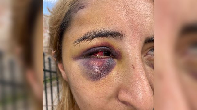 Fue dada por muerta por su ex pareja luego de una golpiza, la salvó su hija de doce años