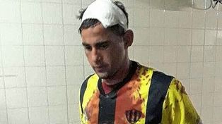Un jugador de Wanderer´s terminó con un corte en el cuero cabelludo tras los incidentes.