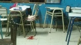 Un estudiante de 16 años baleó en la cara a una compañera de 14 en Salta