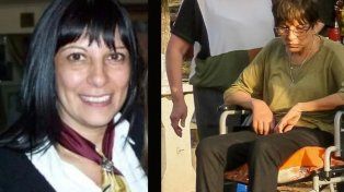 Graciela Marizza, antes y después de consumir agua envenenada con nafta durante mucho tiempo.