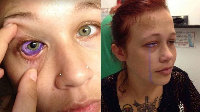 Una modelo se tatuó el ojo y le pasó lo peor