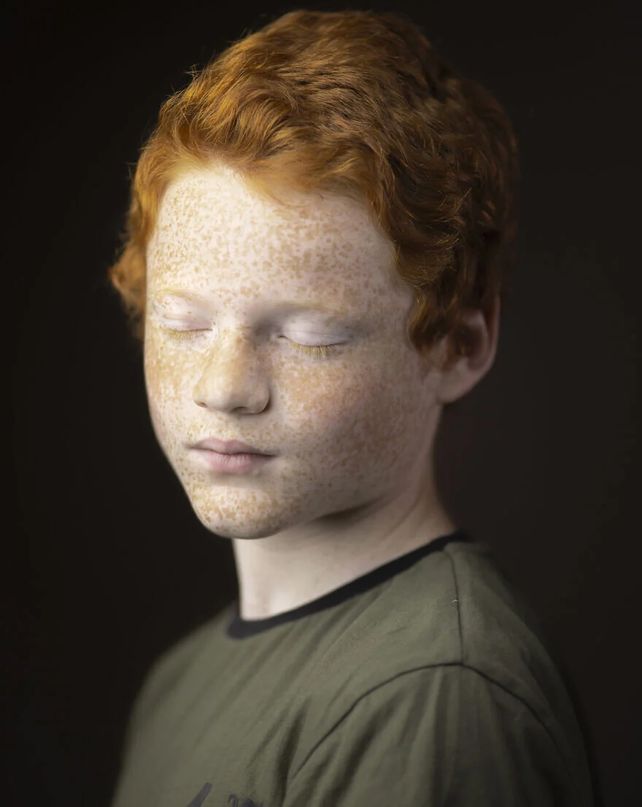 Kieran Dodds fotografió el particular universo de las personas pelirrojas.