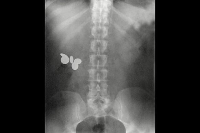 Atorados, las 100 radiografías más insólitas