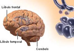 Descubren el sitio del cerebro en el que se origina el amor