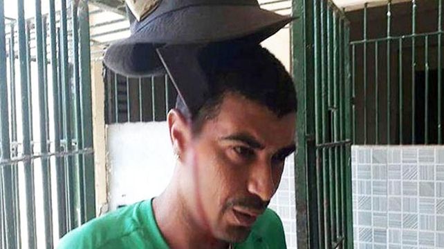 Preso brasileño con un machete clavado en la cabeza ni se inmuta