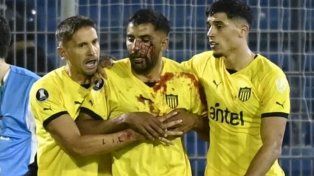 Escándalo: Un jugador de Peñarol recibió un corte tras ser agredido por un hincha de Rosario Central