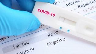 Desarrollan un test que detecta el virus hasta cuatro veces más rápido