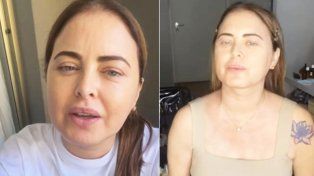 La modelo Silvina Luna, que permanecía hace 15 días conectada a un respirador, fue extubada y estaría respondiendo favorablemente