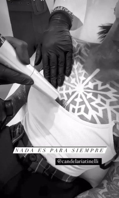 Cande Tinelli decidió borrarse varios de sus tatuajes y mostró el tratamiento