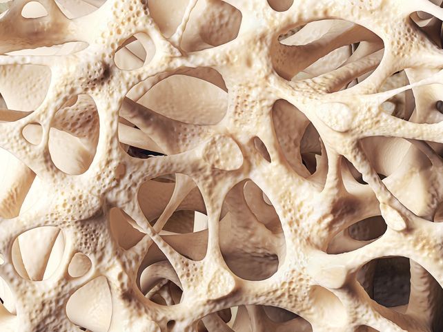 Osteoporosis