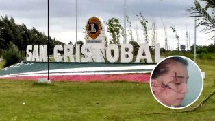 San Cristóbal se moviliza por Delfina, la adolescente de 15 años atacada brutalmente por una patota de menores