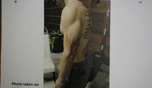 Inéditas y sangrientas fotos del caso Pistorius