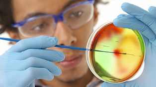 Las muertes por bacterias superresistentes escalan y son más que las causadas por el sida