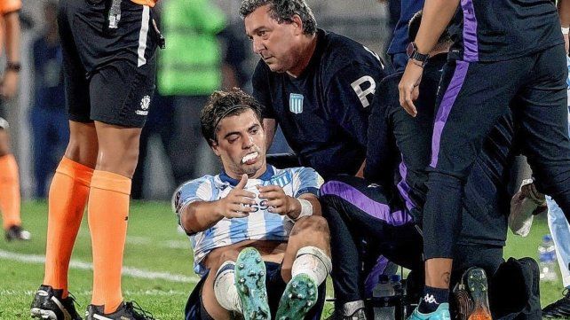 Santiago Sosa fue operado este lunes luego de sufrir la fractura del hueso malar. Santiago Sosa fue operado este lunes luego de sufrir la fractura del hueso malar.