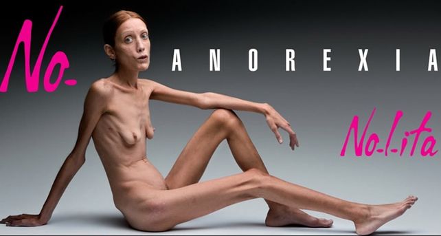 Falleci&oacute; la modelo francesa que desnud&oacute; su anorexia