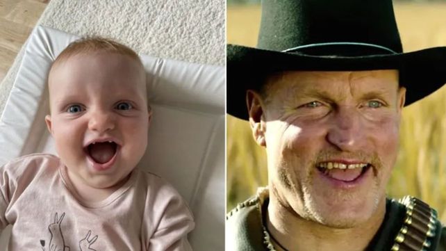 Una bebé igual a Woody Harrelson se volvió viral y recibió un curioso poema