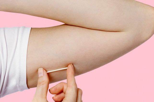 La salud pública distribuyó 206 mil implantes subdérmicos en un año