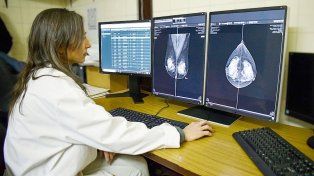 El hospital San Martín de Paraná incorporó equipo para informar mamografías. Consta de dos monitores de alta resolución y pc con capacidad de almacenamiento&nbsp;