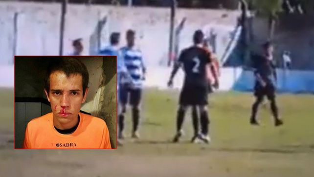 Se calentó con el árbitro y le aplicó un cabezazo descalificador