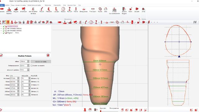 Diseño y fabricación de productos ortoprotésicos
