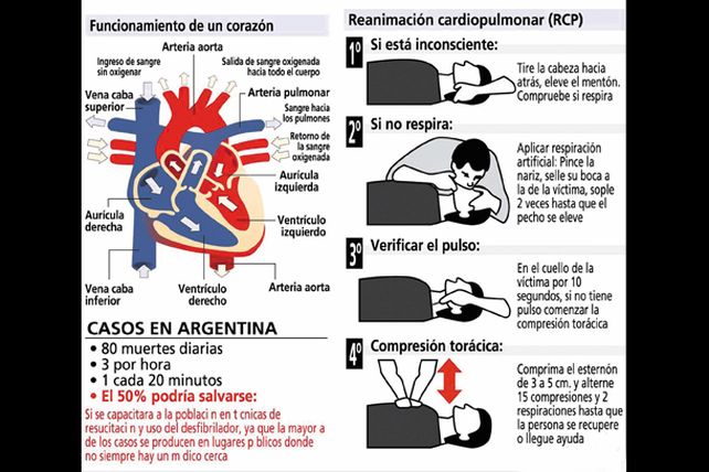 Muerte súbita: prevenirla es muy difícil, pero lo importante es actuar a tiempo