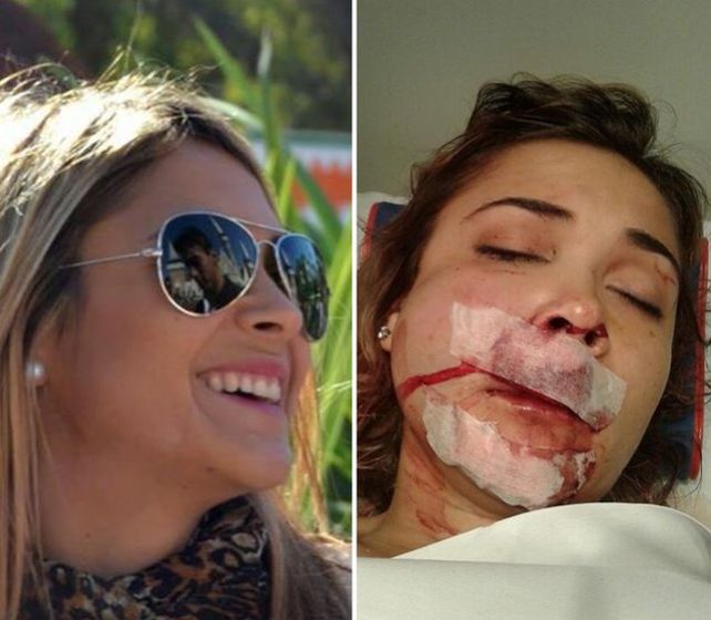 Así la dejó un grupo de patovicas tras una salvaje golpiza