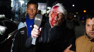 El periodista Cristian Mercatante fue agredido en el cierre de campaña de Milei en la localidad de Moreno